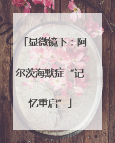 显微镜下：阿尔茨海默症“记忆重启”